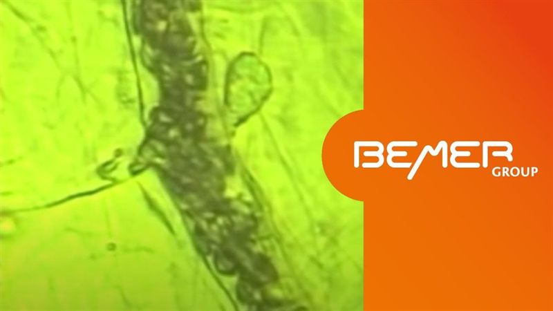 Vorschaubild des YouTube-Videos zur Bemer-Therapie